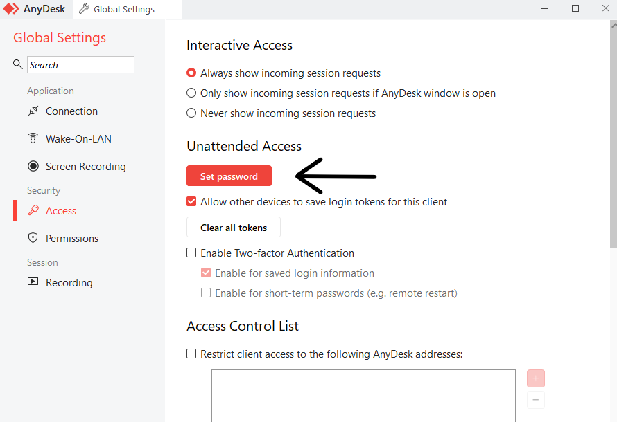 Global Settings — חץ מצביע על Set password תחת Unattended Access